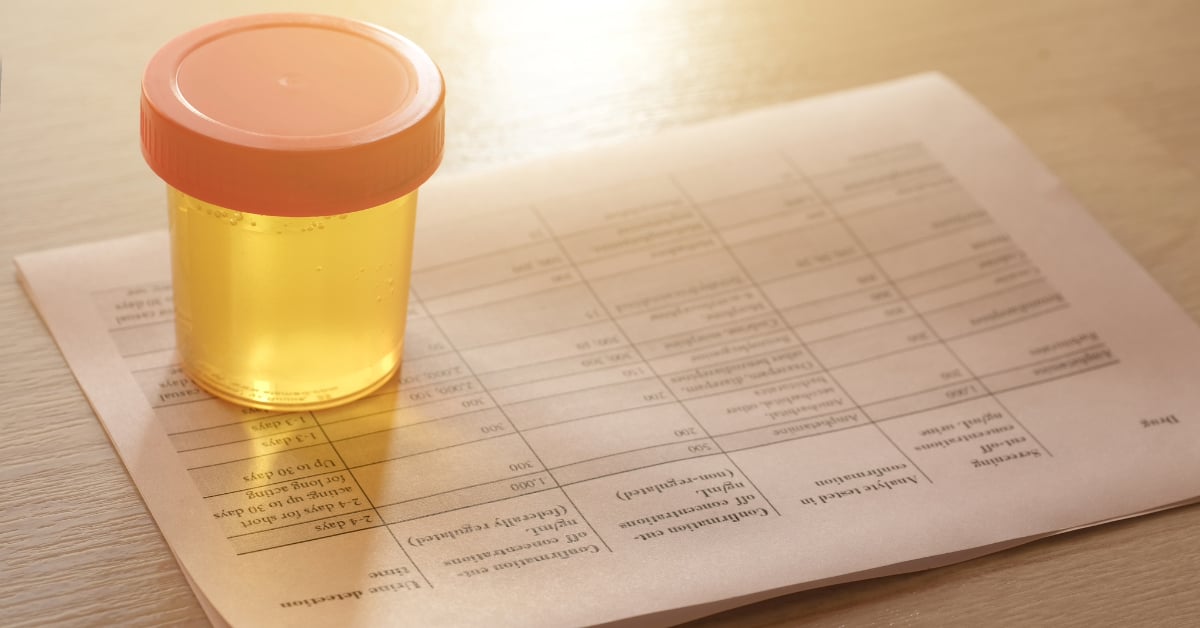 Urinalysis, Drug Testing, Drug. Plastic jars for medical tests. Urine test.